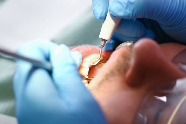 Best Cosmetic Emergency Dentistry in Advae, NC
